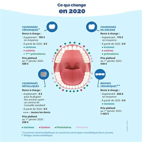 Coût des soins dentaires en France