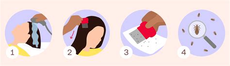 Kid's Poux, Franchise de traitement des poux