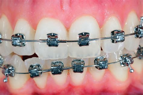 Orthodontie